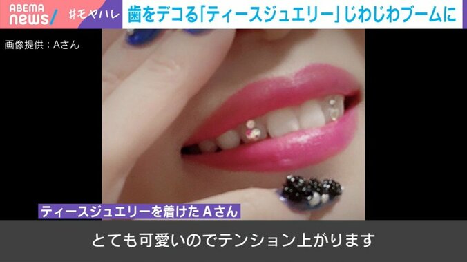ティースジュエリーを着けたAさん
