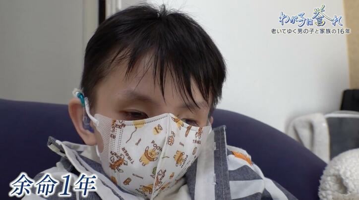 【写真・画像】5倍の速さで老化が進む「コケイン症候群」を抱える男の子 余命１年…家族の決断は 「わが子は誉れ」懸命に生きた16年の記録　8枚目
