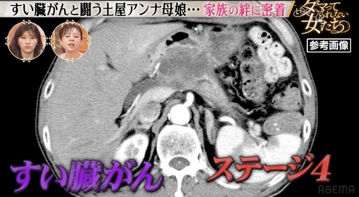 【写真・画像】土屋アンナの母、ステージ4のすい臓がんで1年前に1年半の余命宣告されていた「胃の不調から始まった」　2枚目