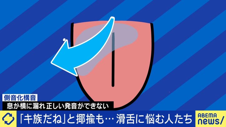 滑舌の仕組み