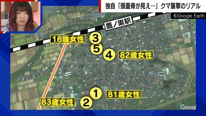 「頭蓋骨が開いてた。もう死ぬんだなと」クマ被害者を独自取材　頭は30針以上の怪我、耳たぶを噛みちぎられ、あと5mmで失明の恐れも…被害者が語った「恐怖の瞬間」