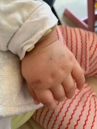 東尾理子『点滴』