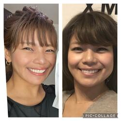  あいのり・クロ、整形をする前の自身の顔を公開「微妙に変わったけれど」 