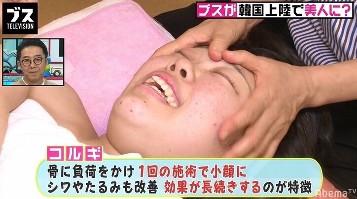 スピワゴ小沢、韓国の整形外科医の衝撃発言を紹介「顔を見たら、どこを直せばアイドルになれるのかわかる」