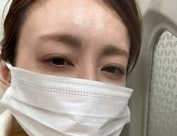 高橋真麻、幼少期から40年近く悩まされ続けている重度の花粉症「とんでもないことになっています」 