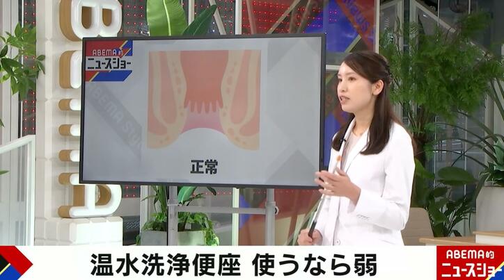 【写真・画像】肛門内科医は洗浄便座を使わない…洗いすぎはかえって危険「腸の粘膜を刺激してしまう」「使う場合は皮膚のところを“弱”で洗うだけ」　1枚目