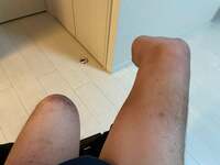 山田千紘『幻肢痛に朝から苦しめられてます』