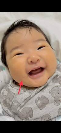 内山琴『エクボ発見!!!』