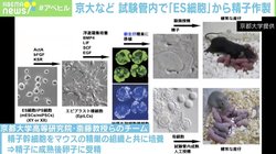 「ES細胞」で女性同士の子どもが出産可能に？ 専門家「ヒトへの応用はまだ」