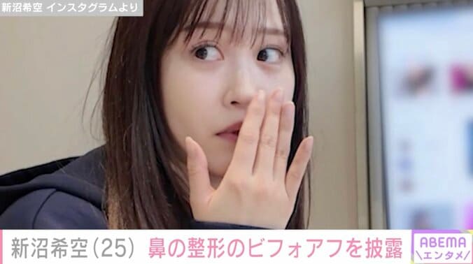 【写真・画像】2024年に「つばきファクトリー」を卒業・新沼希空（25）、鼻の整形のビフォアフを披露「ずっと鼻がコンプレックス」　2枚目