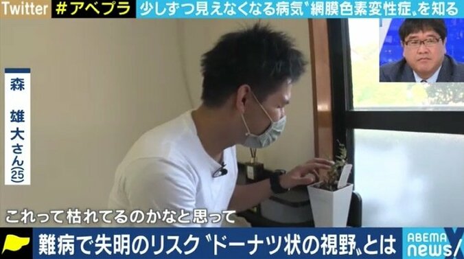 少しずつ奪われる視力、視野…“見えることが前提の社会”で悩む5万人の網膜色素変性症患者たち 2枚目