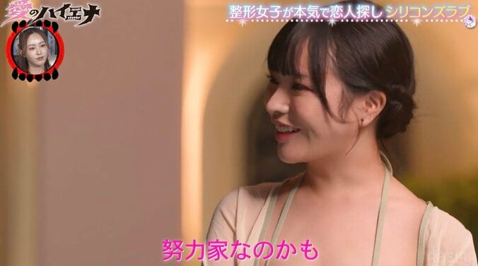 美人上智大生（21歳）、“整形前”中2の頃の顔を公開し男子驚き「確かに系統が違うかも…」 2枚目