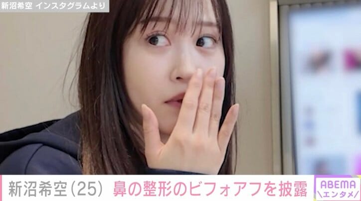 【写真・画像】2024年に「つばきファクトリー」を卒業・新沼希空(25)、鼻の整形のビフォアフを披露「ずっと鼻がコンプレックス」 2枚目