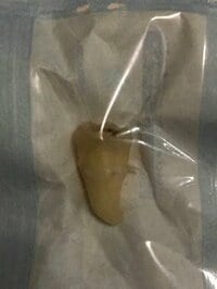 田中卓志、親知らず抜いたことを報告「なぜ41歳になって今頃痛くなるのか？」と怒り