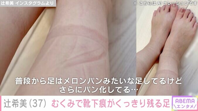 【写真・画像】第5子妊娠中・辻希美「ずっと靴下はいてるのもキツい」むくみで悩む足の写真を公開　2枚目