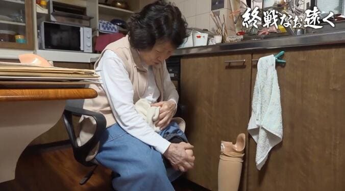 左足を切断した安野輝子さん（86）