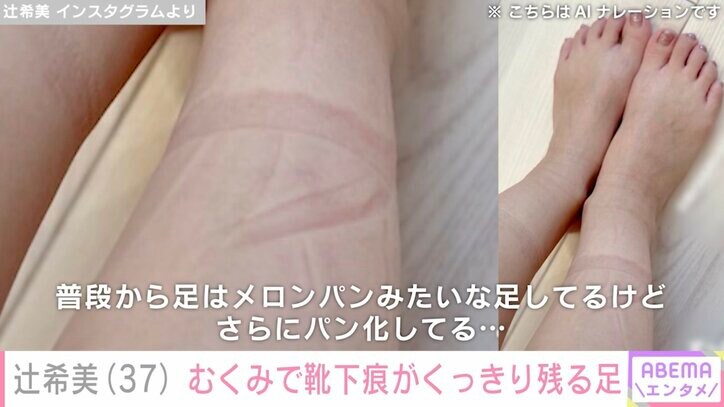 【写真・画像】第5子妊娠中・辻希美「ずっと靴下はいてるのもキツい」むくみで悩む足の写真を公開 2枚目