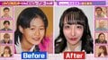 100回以上整形した元アイドル、ビフォーアフターを公開「違う子だ！」香取慎吾も驚き