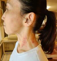 モト冬樹『顔と体の矯正』