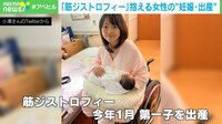 「筋ジストロフィー」抱える女性の"妊娠・出産"