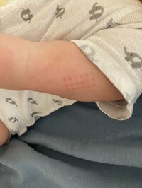 ニッチェ 江上敬子『だんだん腫れてきた!』