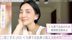 2児の母でモデル・二宮こずえ（43）、くも膜下出血乗り越え約1年ぶりに活動再開 指定難病「もやもや病」の手術も