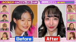 100回以上整形した元アイドル、ビフォーアフターを公開「違う子だ！」香取慎吾も驚き