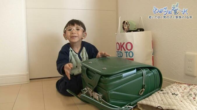 【写真・画像】5倍の速さで老化が進む「コケイン症候群」を抱える男の子 余命１年…家族の決断は 「わが子は誉れ」懸命に生きた16年の記録　2枚目