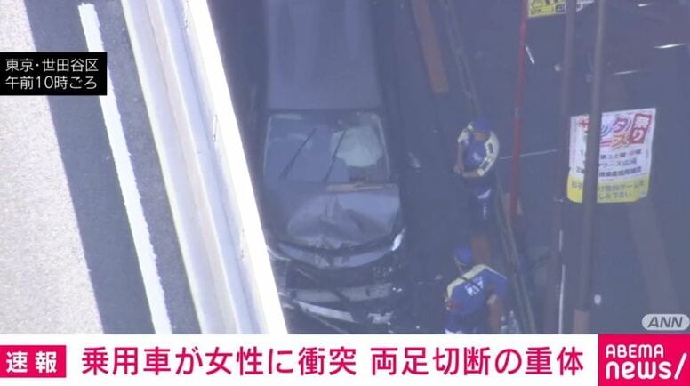 乗用車が女性に衝突 両足切断の重体