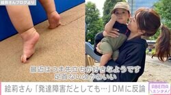 「発達障害がどーのこうの」才賀紀左衛門のパートナー絵莉さん、インスタDMに反論