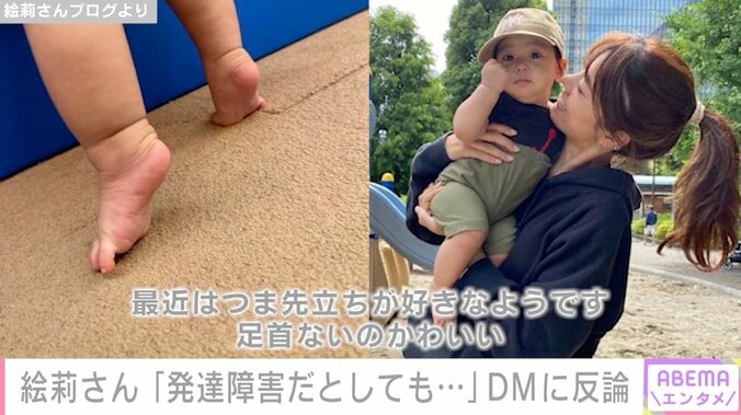 「発達障害がどーのこうの」才賀紀左衛門のパートナー絵莉さん、インスタDMに反論 1枚目