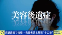【映像】「口元の感覚がなくなって…」美容整形後の“後遺症”患者増加