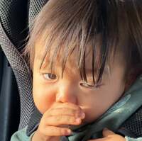 桃『先天性眼瞼下垂症のこと。手術をすることにしました！』