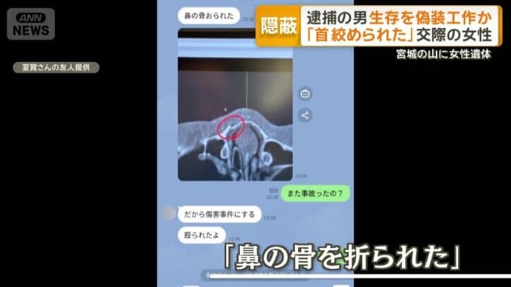 レントゲン写真も