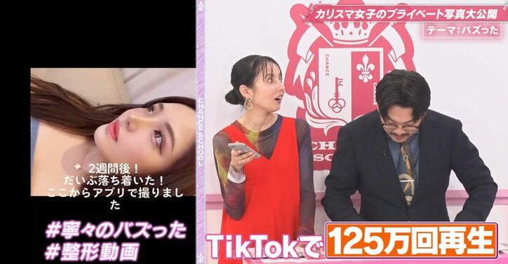 【写真・画像】整形後の経過を詳細に投稿した画像が大バズリのキャバ嬢、オズワルド伊藤「時代が全然違いますね」　2枚目