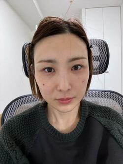  はあちゅう氏、全身麻酔で整形手術を受けた結果「目の中に膜がはっているような」 