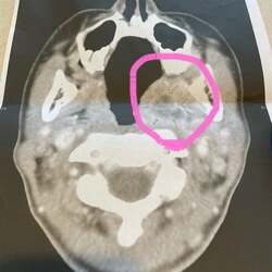  料理研究家・桜井奈々、約3日で最悪な状態になった症状「何度も手術が必要ということ」 