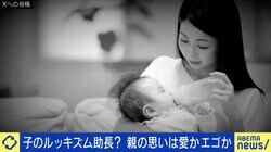赤ちゃんのヘルメット治療が物議…“親心”が子のルッキズムを助長？高須幹弥院長「責任を感じて『治してあげたい』気持ちはわからなくもない」