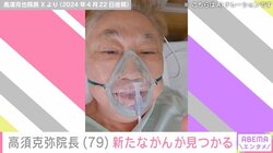 「次々と見つかる新しい癌なう」高須院長、新たながんが見つかったことを報告