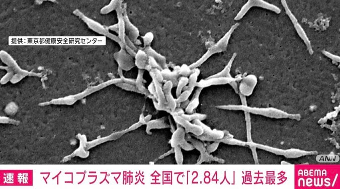 【写真・画像】マイコプラズマ肺炎患者数 3週ぶりに増加 過去最多を更新　1枚目