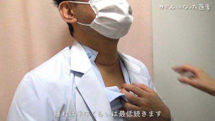 「“なったことないでしょ”って言われたら“おっしゃる通り”としか言えなかったので…」がんに罹った専門医の1年