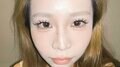 「CMもしてるような大手クリニックで…」鼻整形に失敗した美女、修正手術前の写真に「これダメじゃん!」「肉眼でわかる!」驚きの声