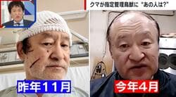 クマが「指定管理鳥獣」に追加も… 6ヵ月前にクマに襲われた被害男性、体は回復傾向も癒えない「心の傷」