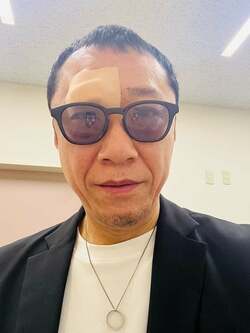 幹てつや、救急車で運ばれ数針縫ったことを報告「痛くて何も言えなかった」 