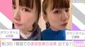 あいのり桃「韓国での美容医療の成果、出てる？」ダウンタイム4日目と2週間後を公開