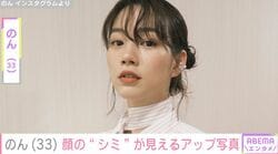 のん（33）、顔の“シミ”が見えるアップ写真に「めっちゃ可愛い」「ラフな格好でどこで撮っても絵になる」など反響