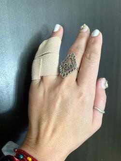  奥山佳恵、レントゲンの検査を受けた結果を報告「お大事に」「痛そう」の声 