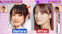顔全パーツ整形の福岡みなみ、ビフォーの顔に美容外科医が本音ポロリ