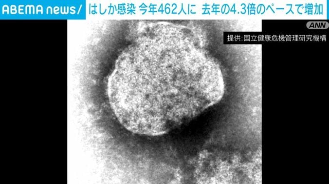 はしかウイルス
