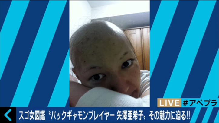 子宮体ガンで余命1年と宣告されるも世界王者に　バックギャモンプレイヤー・矢澤亜希子さん